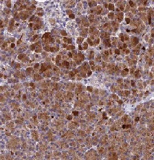 Immunohistochemistry (Formalin/PFA-fixed paraffin-embedded sections) - Anti-PZP antibody (AB122718)