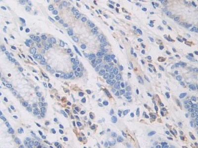 Immunohistochemistry (Formalin/PFA-fixed paraffin-embedded sections) - Anti-PZP antibody (AB233166)
