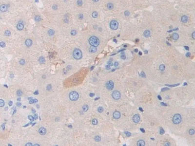 Immunohistochemistry (Formalin/PFA-fixed paraffin-embedded sections) - Anti-PZP antibody (AB233166)