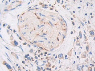 Immunohistochemistry (Formalin/PFA-fixed paraffin-embedded sections) - Anti-PZP antibody (AB233166)