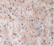 Immunohistochemistry (Formalin/PFA-fixed paraffin-embedded sections) - Anti-PZP antibody (AB233166)