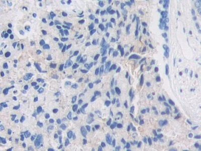 Immunohistochemistry (Formalin/PFA-fixed paraffin-embedded sections) - Anti-PZP antibody (AB233166)