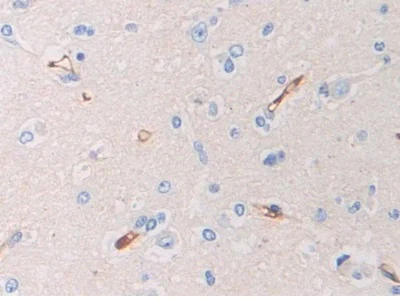 Immunohistochemistry (Formalin/PFA-fixed paraffin-embedded sections) - Anti-PZP antibody (AB233166)