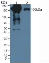 Western blot - Anti-PZP antibody (AB233166)