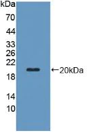 Western blot - Anti-PZP antibody (AB233166)