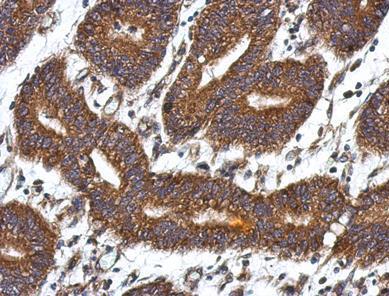 Immunohistochemistry (Formalin/PFA-fixed paraffin-embedded sections) - Anti-QDPR/DHPR antibody (AB126150), expandable thumbnail