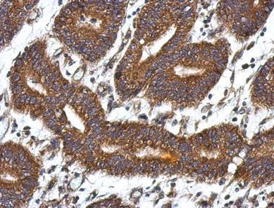 Immunohistochemistry (Formalin/PFA-fixed paraffin-embedded sections) - Anti-QDPR/DHPR antibody (AB126150)