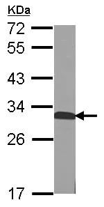 Western blot - Anti-QDPR/DHPR antibody (AB126150)