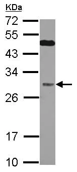 Western blot - Anti-QDPR/DHPR antibody (AB126150)