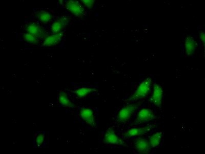 Immunocytochemistry/ Immunofluorescence - Anti-QDPR/DHPR antibody (AB232983)
