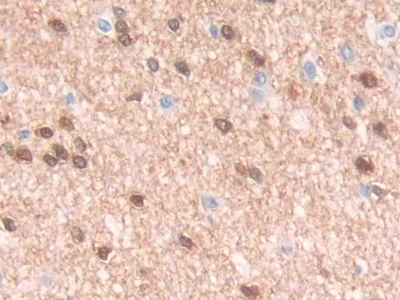 Immunohistochemistry (Formalin/PFA-fixed paraffin-embedded sections) - Anti-QDPR/DHPR antibody (AB232983)