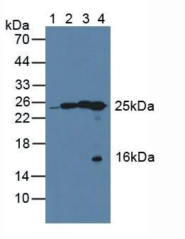 Western blot - Anti-QDPR/DHPR antibody (AB232983)