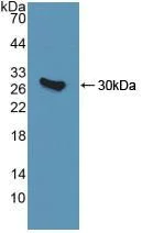 Western blot - Anti-QDPR/DHPR antibody (AB232983)