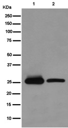 Western blot - Anti-QDPR/DHPR antibody [EP12595] (AB186411)