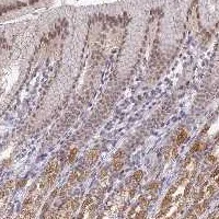Immunohistochemistry (Formalin/PFA-fixed paraffin-embedded sections) - Anti-QIL1 antibody (AB122807)