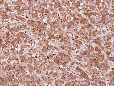 Immunohistochemistry (Formalin/PFA-fixed paraffin-embedded sections) - Anti-QKI antibody (AB102086), expandable thumbnail