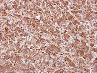 Immunohistochemistry (Formalin/PFA-fixed paraffin-embedded sections) - Anti-QKI antibody (AB102086)