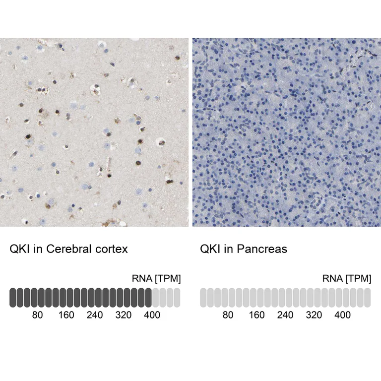 Immunohistochemistry (Formalin/PFA-fixed paraffin-embedded sections) - Anti-QKI Antibody (AB327192)