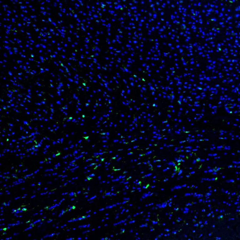 Immunohistochemistry (Formalin/PFA-fixed paraffin-embedded sections) - Anti-QKI Antibody (AB327192)