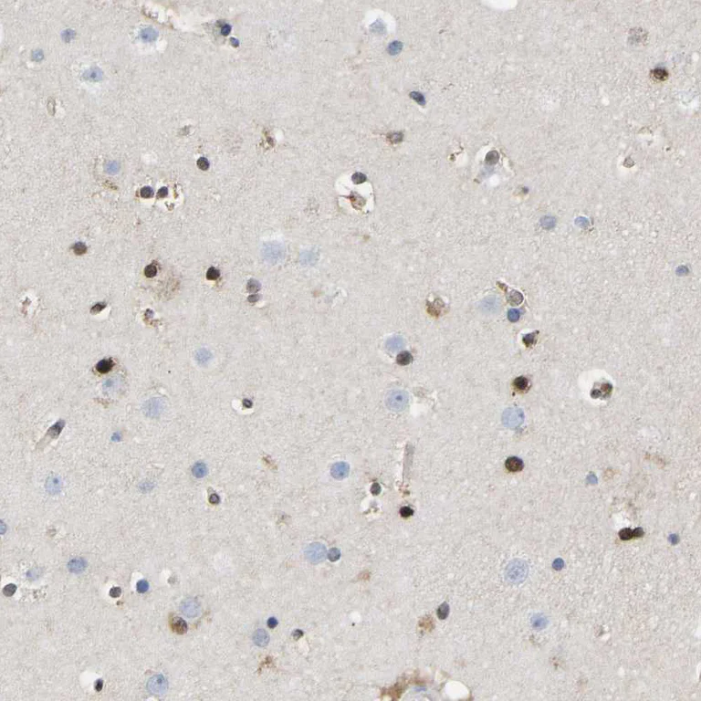 Immunohistochemistry (Formalin/PFA-fixed paraffin-embedded sections) - Anti-QKI Antibody (AB327192)