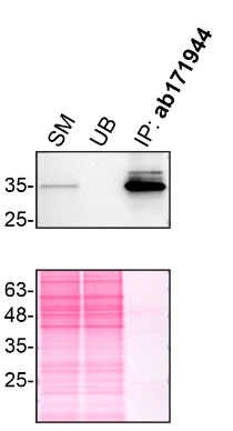 Immunoprecipitation - Anti-QPRT antibody [EPR11941(B)] (AB171944)