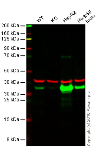 Western blot - Anti-QPRT antibody [EPR11941(B)] (AB171944)