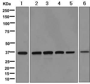 Western blot - Anti-QPRT antibody [EPR11941(B)] - BSA and Azide free (AB249663)