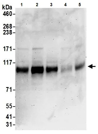 Western blot - Anti-QRICH1 antibody (AB241574)