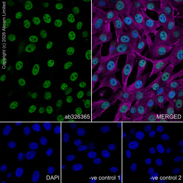 Immunocytochemistry/ Immunofluorescence - Anti-QRICH1 antibody [EPR30491-560] (AB326365)