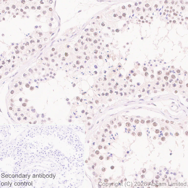 Immunohistochemistry (Formalin/PFA-fixed paraffin-embedded sections) - Anti-QRICH1 antibody [EPR30491-560] (AB326365)