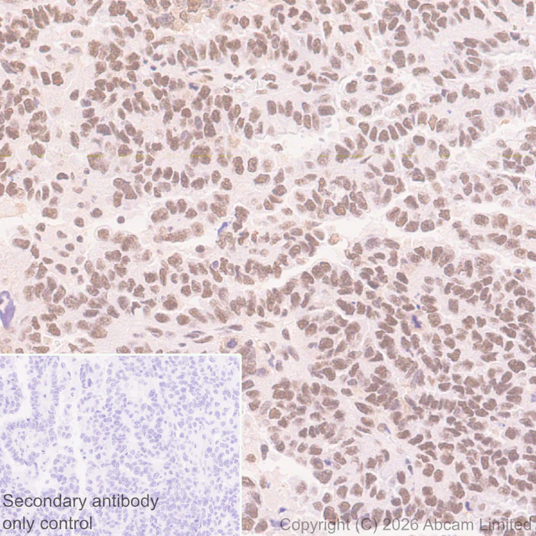 Immunohistochemistry (Formalin/PFA-fixed paraffin-embedded sections) - Anti-QRICH1 antibody [EPR30491-560] (AB326365)