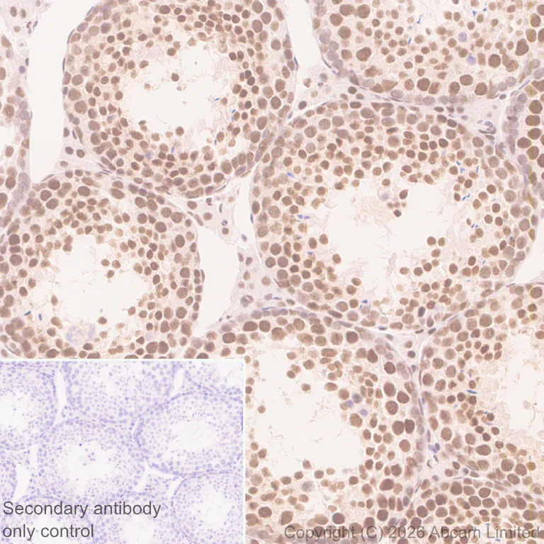 Immunohistochemistry (Formalin/PFA-fixed paraffin-embedded sections) - Anti-QRICH1 antibody [EPR30491-560] (AB326365)