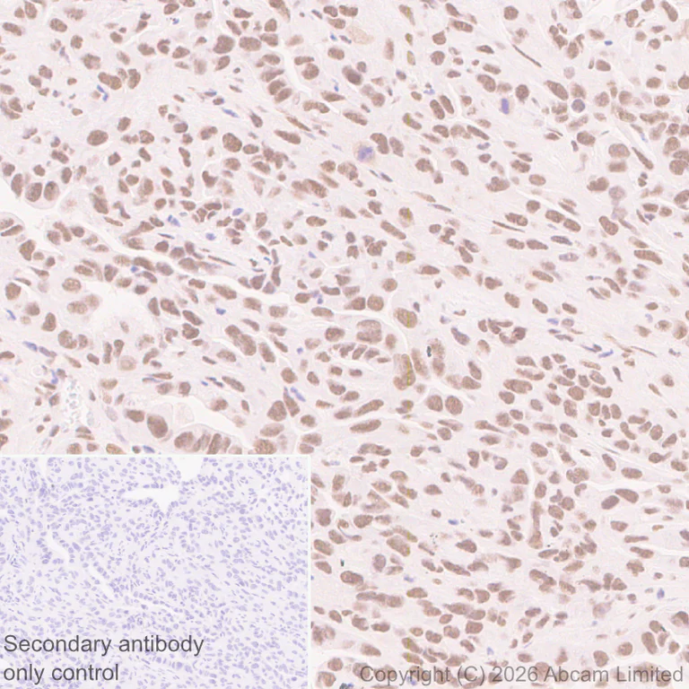 Immunohistochemistry (Formalin/PFA-fixed paraffin-embedded sections) - Anti-QRICH1 antibody [EPR30491-560] (AB326365)