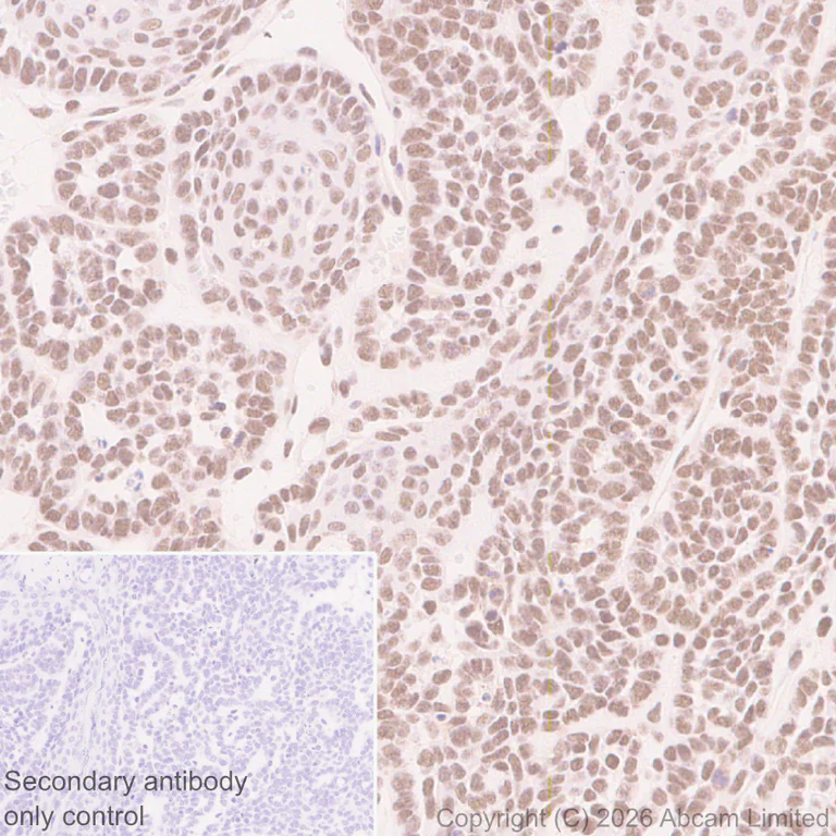Immunohistochemistry (Formalin/PFA-fixed paraffin-embedded sections) - Anti-QRICH1 antibody [EPR30491-560] (AB326365)