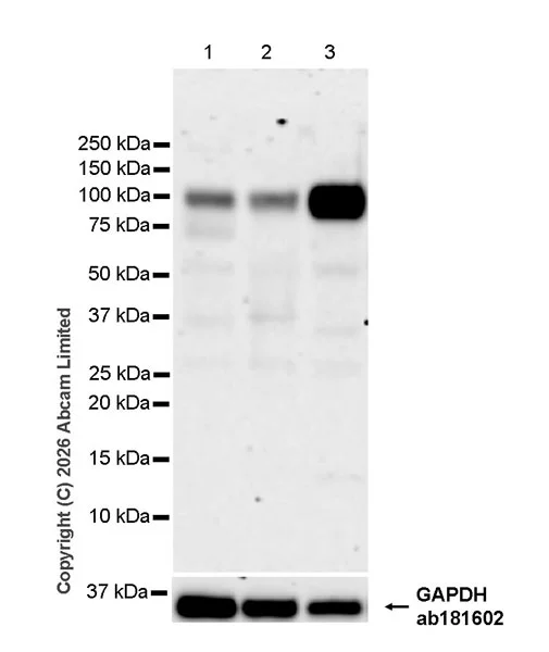 Western blot - Anti-QRICH1 antibody [EPR30491-560] (AB326365)