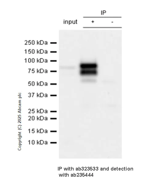 Immunoprecipitation - Anti-Quiescin Q6 antibody [EPR25653-56] (AB323533)