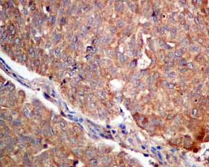 Immunohistochemistry (Formalin/PFA-fixed paraffin-embedded sections) - Anti-Quinone oxidoreductase antibody [EPR10843(B)] (AB154842)