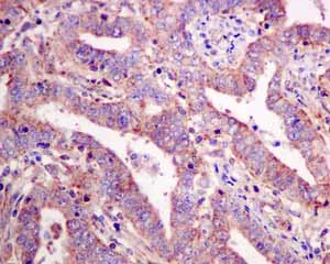 Immunohistochemistry (Formalin/PFA-fixed paraffin-embedded sections) - Anti-Quinone oxidoreductase antibody [EPR10843(B)] - BSA and Azide free (AB249145)