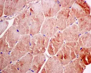 Immunohistochemistry (Formalin/PFA-fixed paraffin-embedded sections) - Anti-Quinone oxidoreductase antibody [EPR10843(B)] - BSA and Azide free (AB249145)
