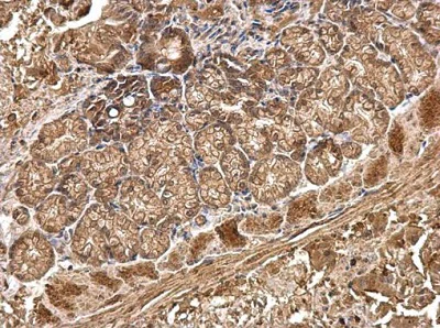 Immunohistochemistry (Formalin/PFA-fixed paraffin-embedded sections) - Anti-R Cadherin antibody (AB227153)