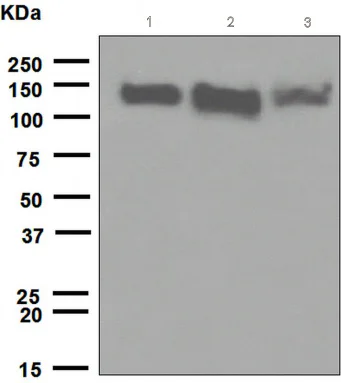 Western blot - Anti-R Cadherin antibody [EPR4836] (AB109242)