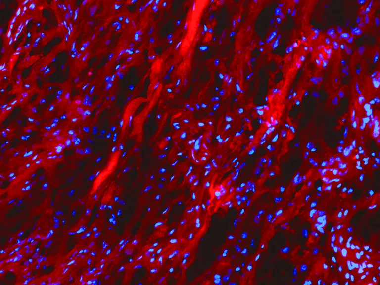 Immunofluorescence - R-CHP Collagen Hybridizing Peptide - Cy3 Conjugate (AB325720)