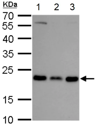 Western blot - Anti-Rab-6 antibody (AB95954)