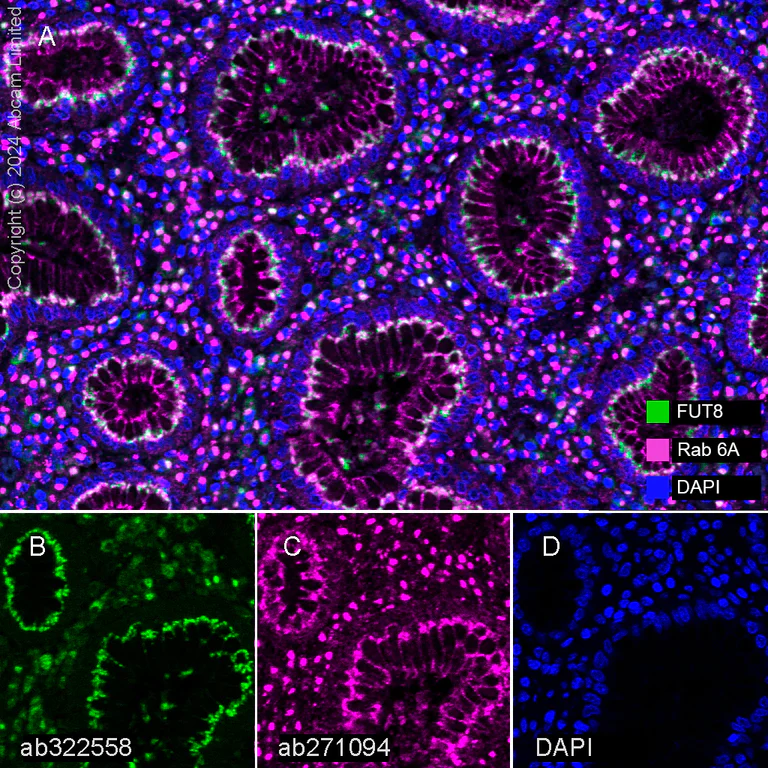 Multiplex immunohistochemistry - Anti-Rab 6A + Rab 6D + Ral-A antibody [EPR24472-24] (AB271094)