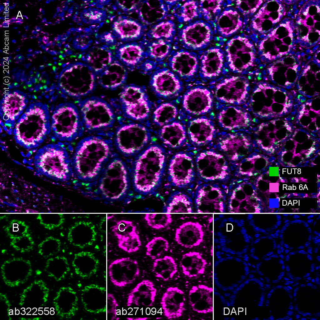 Multiplex immunohistochemistry - Anti-Rab 6A + Rab 6D + Ral-A antibody [EPR24472-24] (ab271094), expandable thumbnail