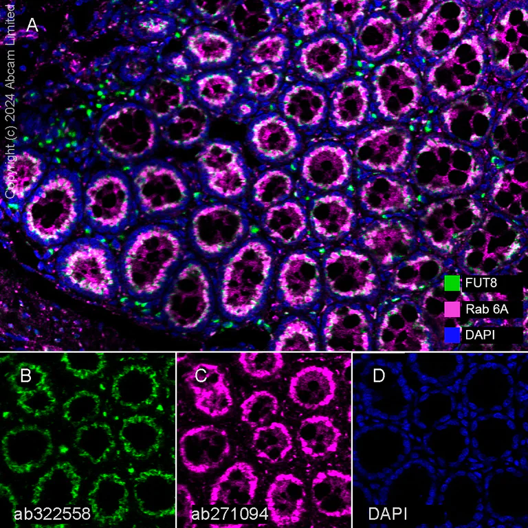 Multiplex immunohistochemistry - Anti-Rab 6A + Rab 6D + Ral-A antibody [EPR24472-24] (AB271094)
