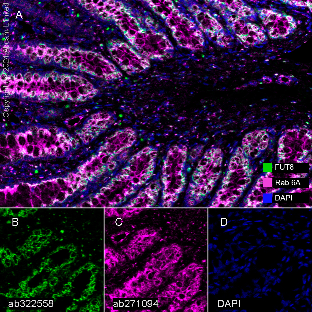 Multiplex immunohistochemistry - Anti-Rab 6A + Rab 6D + Ral-A antibody [EPR24472-24] (ab271094), expandable thumbnail