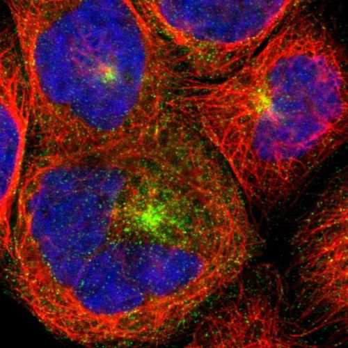 Immunocytochemistry/ Immunofluorescence - Anti-RAB antibody (AB244307)