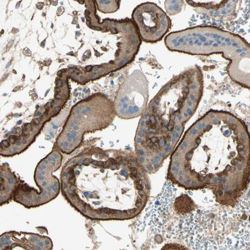 Immunohistochemistry (Formalin/PFA-fixed paraffin-embedded sections) - Anti-RAB antibody (AB244307)