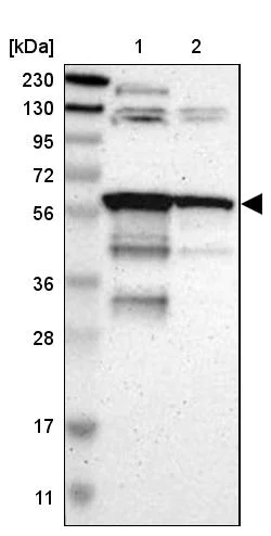 Western blot - Anti-RAB antibody (AB244307)